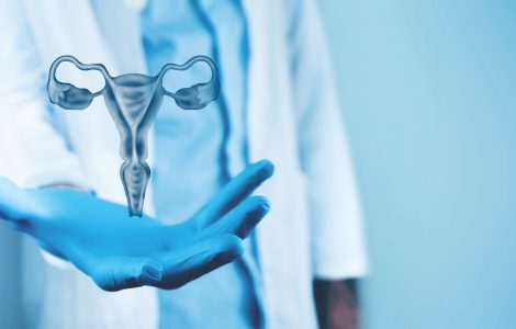 comment savoir kyste ovaire